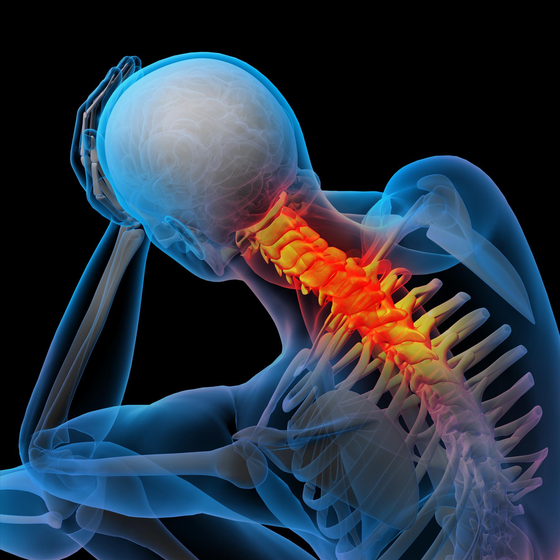 Hiring a Neck Injury Attorney after a Serious Whiplash Injury