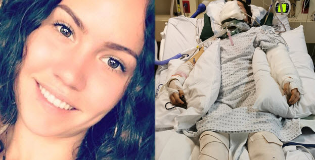 OPCF44 Family Protection Coverage