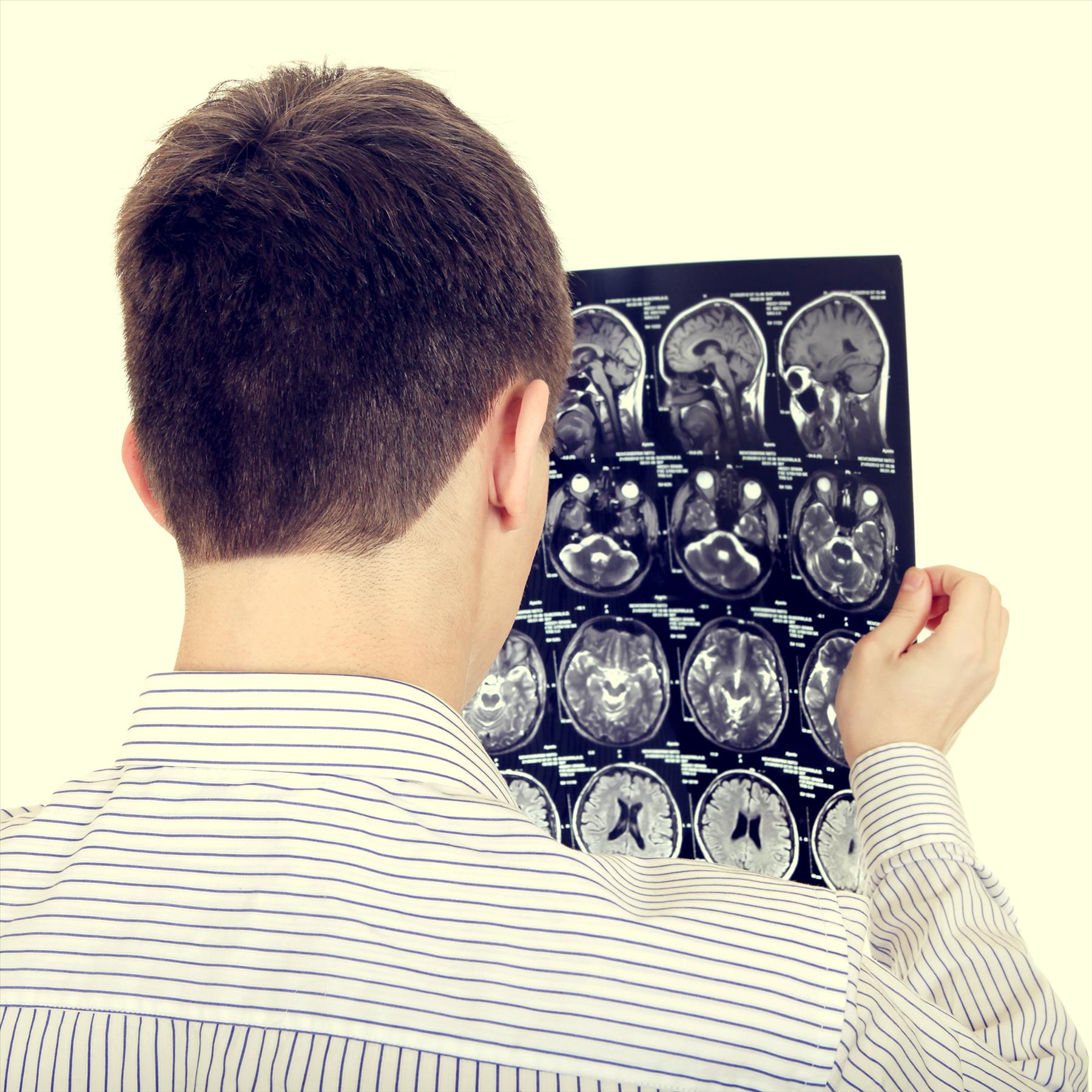 What Is the Law if I Sustained a Brain Injury