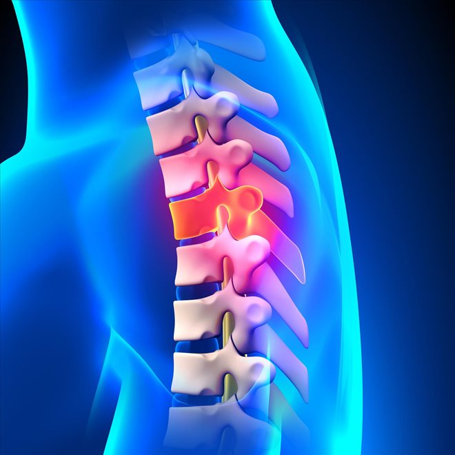 Filing Your Spinal Injury Claims with an Experienced Toronto Personal Injury Lawyer