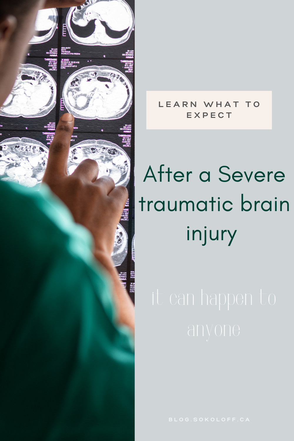 Severe Traumatic Brain Injury: What to Expect