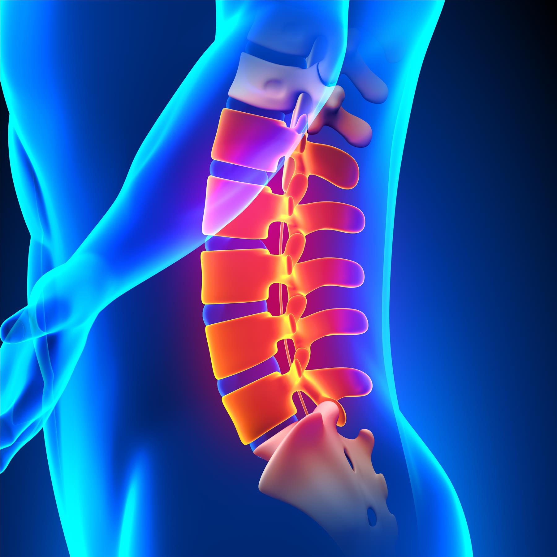 A Personal Injury Lawyer Will Alleviate Financial Stress after a Spinal Injury